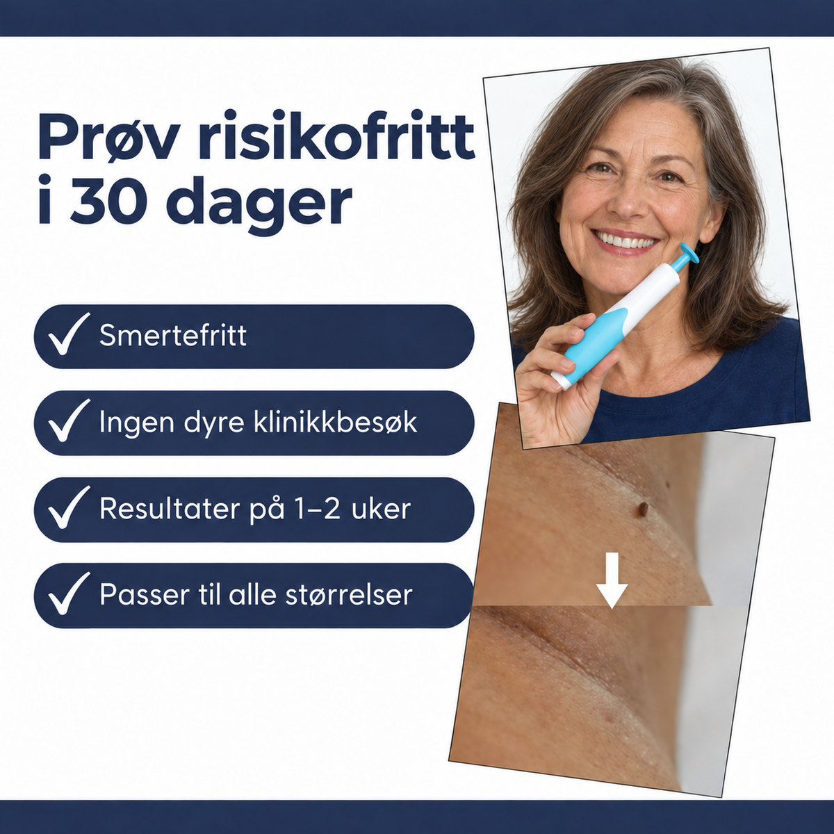Hudflikfjerner